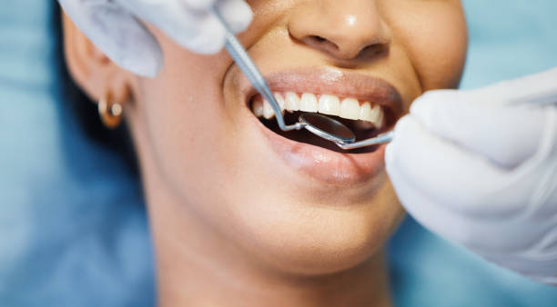 Best Emergency Gum Treatment in Clarksville, IA